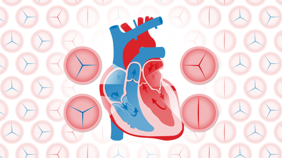 Timing of Intervention in Asymptomatic Patients With Valvular Heart Disease